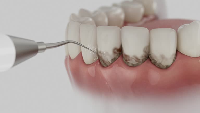 Reliable Dental contractor in Berea, OH by Dentist Open Now